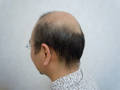 かつらを取ると