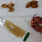 総義歯治療の一例